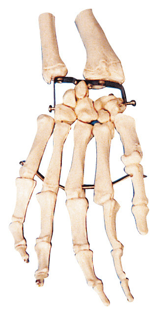 종려 뼈 의과 대학을 위한 인간적인 해부학 모형 훈련 모형