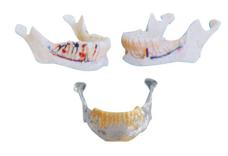 치과의사 이는 신경, 동맥 및 정맥을 가진 턱 모형을 만듭니다
