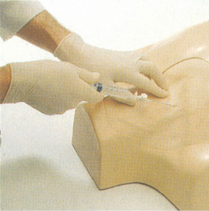 IV, 쇄골 밑 인후, 흉상 임상 가장 동료를 위한 넓적다리 정맥 빵꾸 훈련