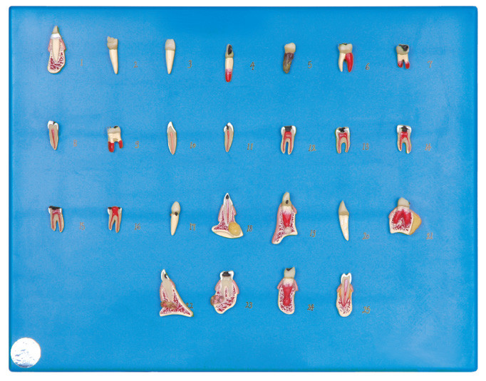 치과 질병 시리즈 병원을 위한 인간적인 이 모형, 학교 훈련의 25의 종류
