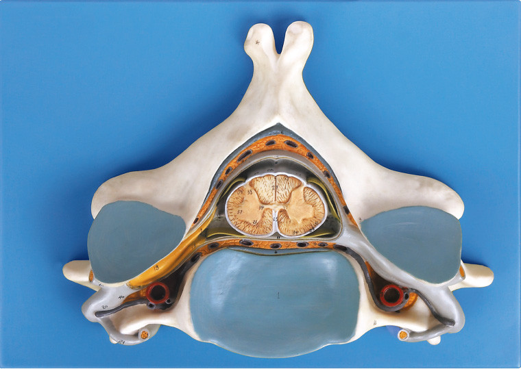 척수 및 신경 해부 인간적인 해골 모형을 가진 다섯번째 자궁 경관 Vertrebra