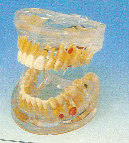 성숙한 투명한 치과 병리 대학 훈련을 위한 인간적인 이 모형