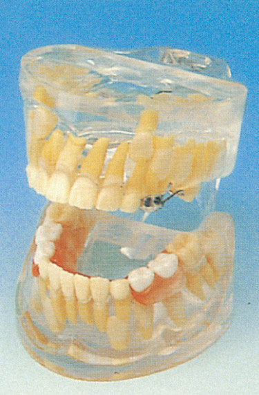 치과 학교 인간적인 이 모형/투명한 젖니 발달 모형