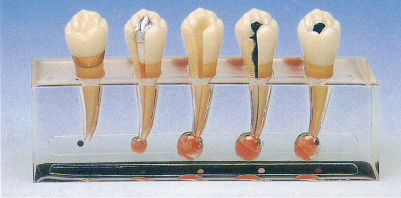 무수 치과술의 임상 병리 모형은 진료소 훈련을 위한 5개 부품을 포함합니다